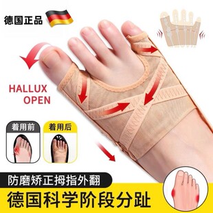 护具拇指外翻小趾内翻脚趾分趾器脚趾头分离纠正分趾器大脚骨