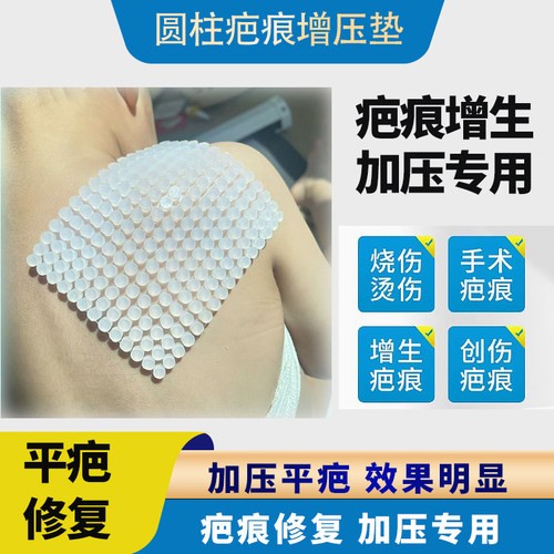 疤痕增生加压垫凸起加压