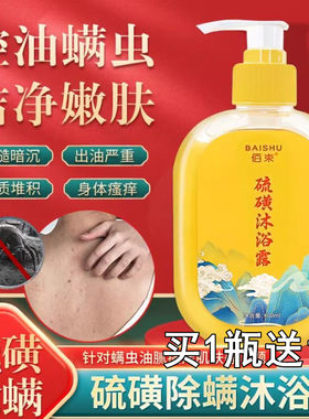 流磺流黄琉璜磺硫磺皂男士沐浴露除螨洗澡液净螨洗脸硫酸液体除痘