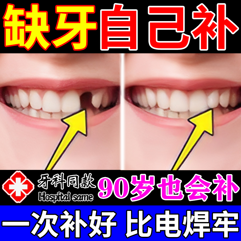 补牙神器自己填充材料永
