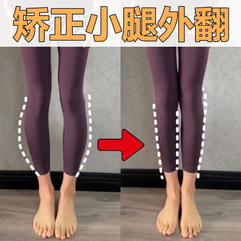 O型X型罗圈腿内外八腿型足外翻足部腿型成人儿童直腿神器矫姿用品