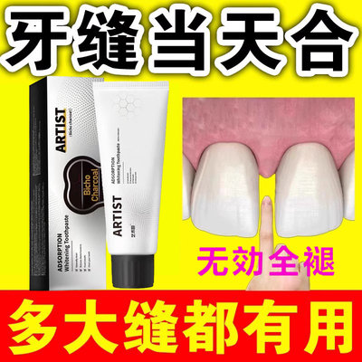 【修补神器】牙缝宽大修复牙膏