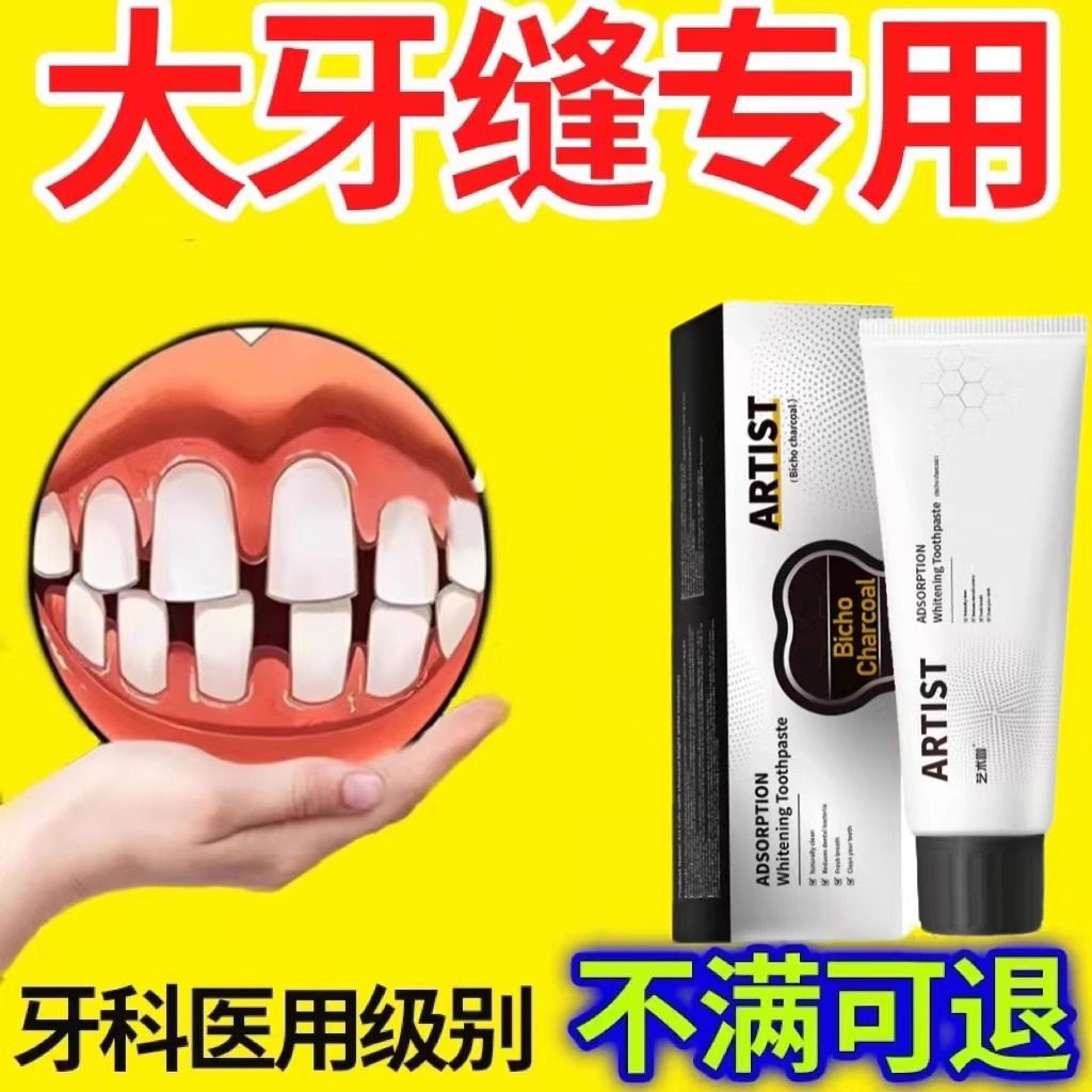 牙缝宽大修复神器补牙缝牙膏填充门牙牙缝大矫正防堵蛀牙牙洞清理