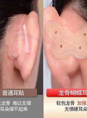 升级新款蝴蝶龙骨精灵耳贴支撑定型过敏招风耳贴面隐形无痛神器