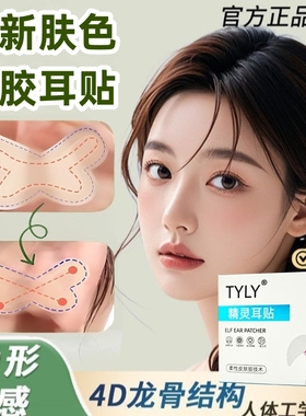 新款蝴蝶龙骨精灵耳贴支撑定型立耳神器脸小招风耳隐形不过敏无痛