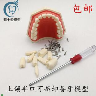 牙科可拆卸牙齿模型上颌半口备牙模型下颌半V口备牙模型包邮