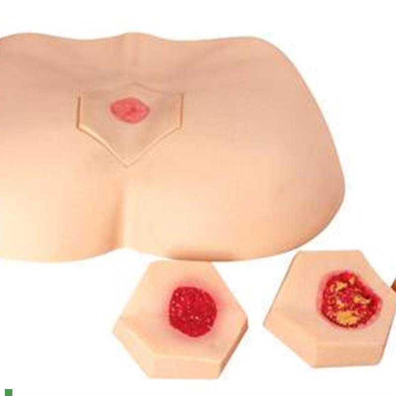 四个不同阶段褥I疮护理训练模型