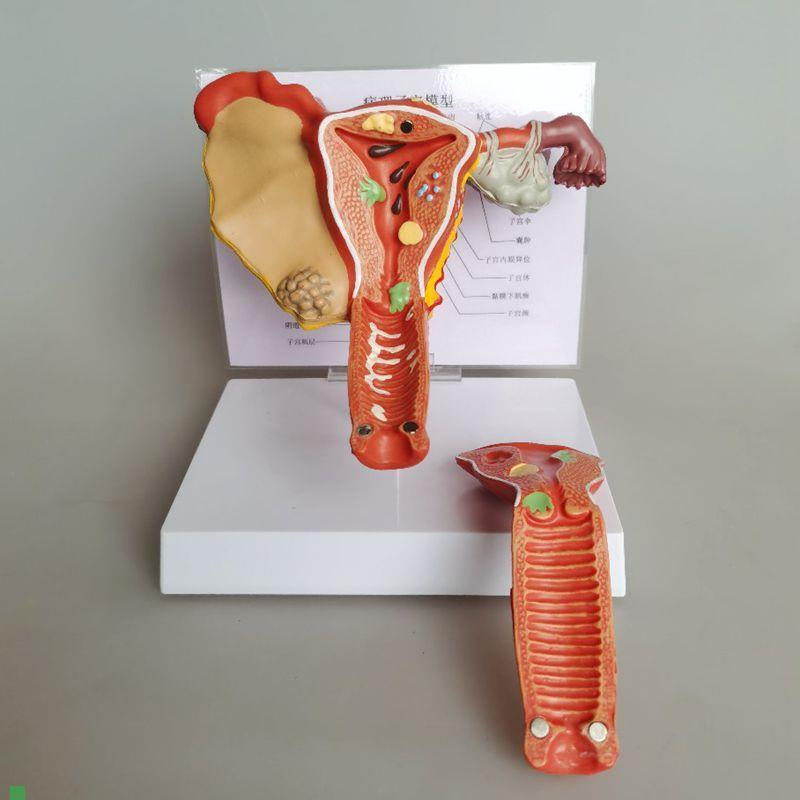 子宫模型卵巢韧带输卵管阴u道妇科生殖医药促销礼品病理子宫瘤跨