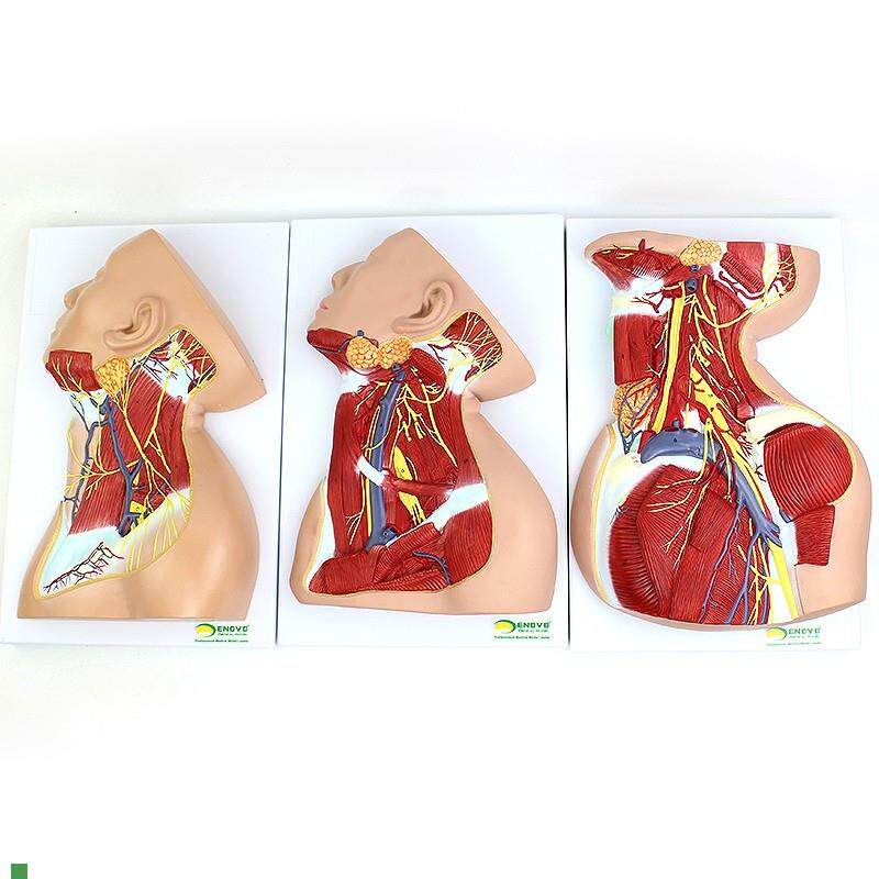 ENOVO颐诺人体颈部局部解剖模型颈H部精细解剖颈部分区颈部模型
