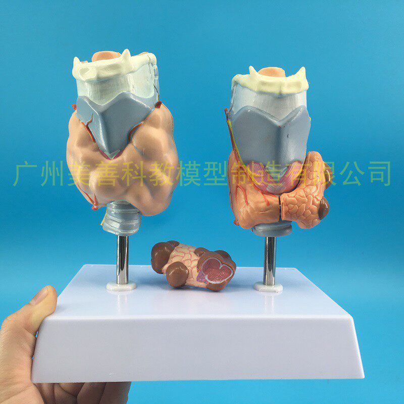 病理甲状腺模型h 喉头解剖模型 甲状腺留 甲状线囊中 甲状线病