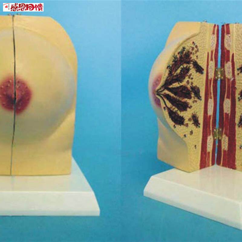 未孕女性乳房解剖q模型 女性乳房模型 催乳师培训道具哺