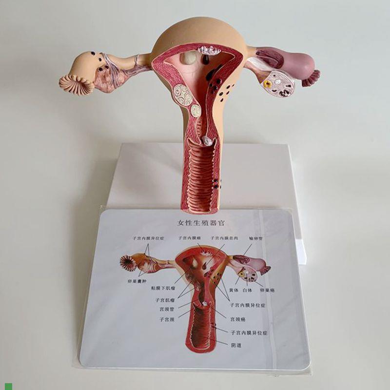 康泰医学子宫模型病理输卵管卵巢妇科生J殖医药促销礼直播跨境热