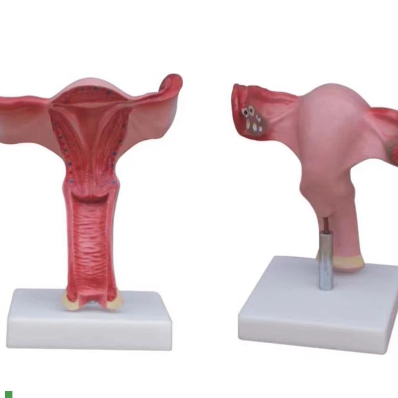 子宫放大模型阴道生殖器官卵巢输卵管剖面教U学训练解剖模具
