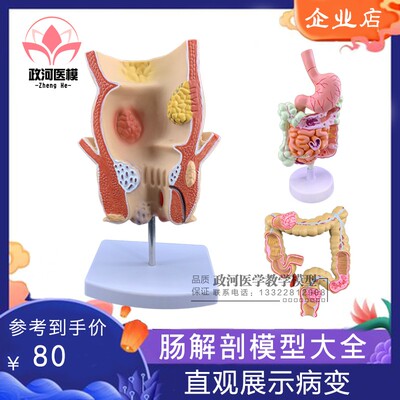人体大肠病理模型 肠胃解剖模型 大肠 盲肠 直肠 十.二指肠模型