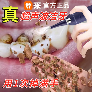声波冲洗牙结石超去除器洁牙仪牙石牙垢污渍家用矫正牙齿清洁神器