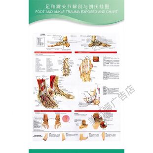 医院骨科病变肩膝髋手腕关节足和踝关节解剖与创伤墙贴海报挂图