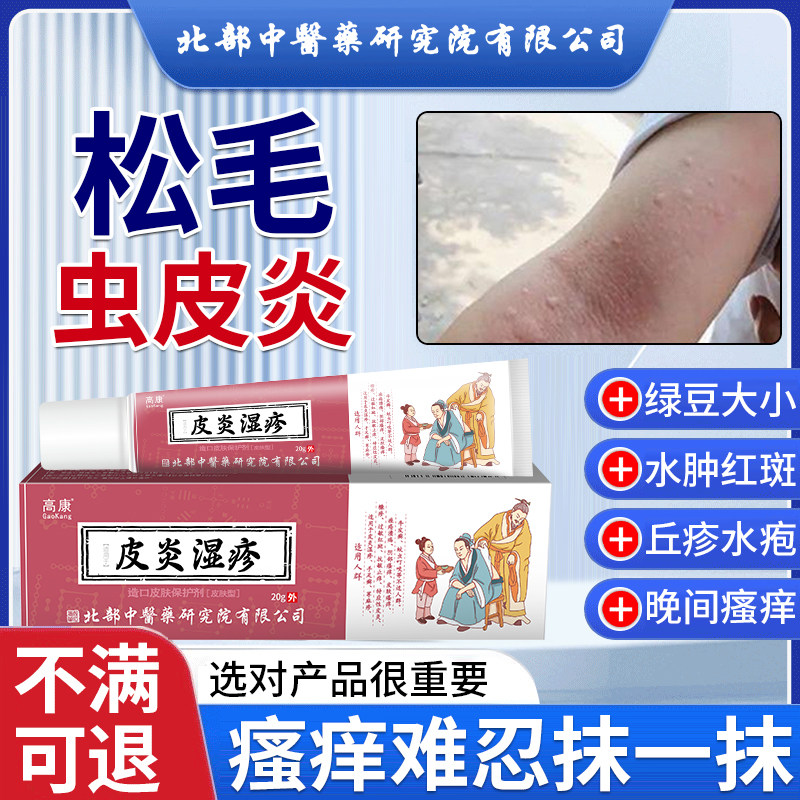 松毛虫皮炎红斑丘疹止痒真菌感染去湿疹根膏神经性皮炎皮肤病癣uc