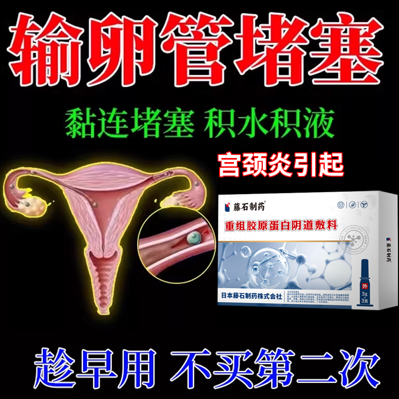 宫腔粘连热敷包