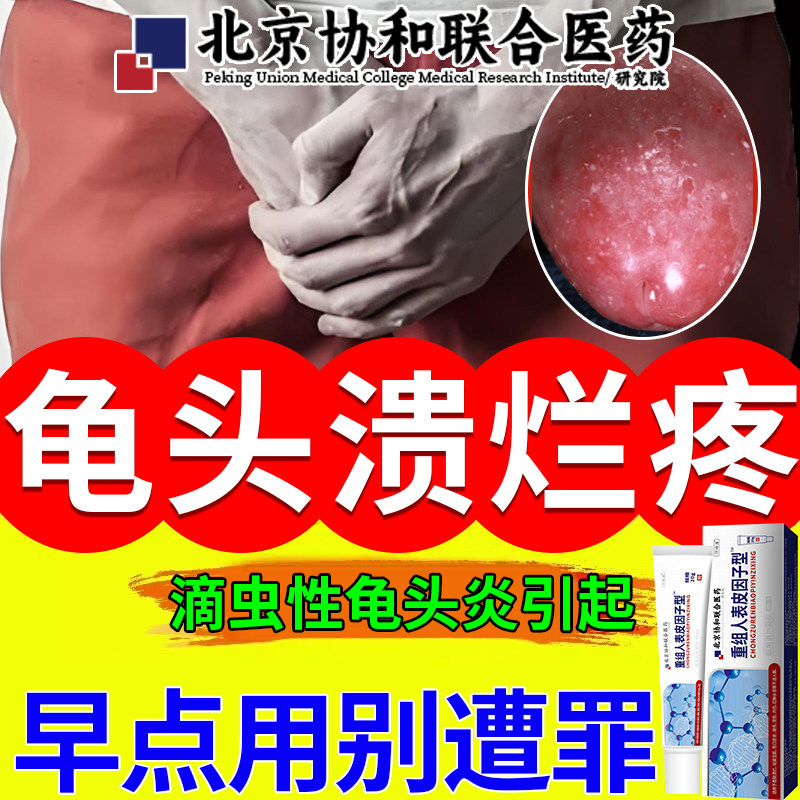 男性龟头炎真菌感染包皮开裂裂口红肿痒龟头溃疡溃烂疼裂口菌qo