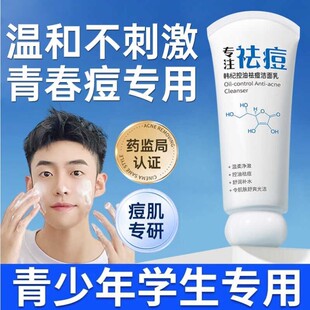青少年洗面奶青春期少女男孩祛痘控油淡化痘印学生去痘专用