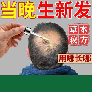 头顶快速增发生发液密发鬼剃头斑秃特效药水防片状脱发男女增发剂