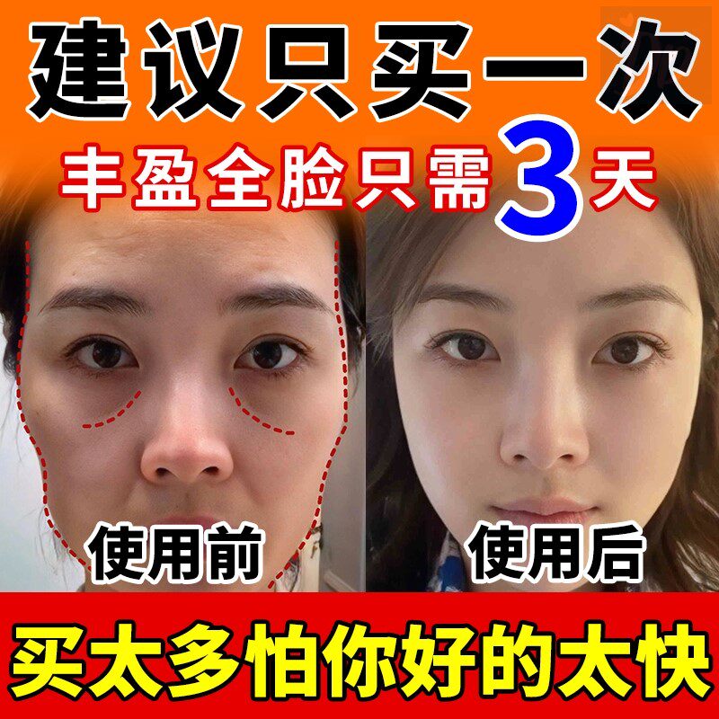 胶原蛋白泪沟面部去丰盈额头太阳穴脸颊眼窝法令除非神器