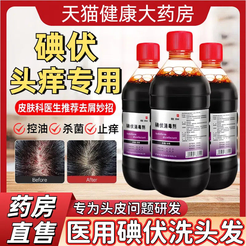 碘伏洗发水洗头发控油头屑止痒专用痘痘除螨杀菌消毒液大瓶500ml