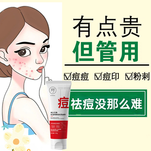 【一抹消灭豆豆神器】青春痘去痘除红肿痘痘 淡化痘印祛痘洗面奶