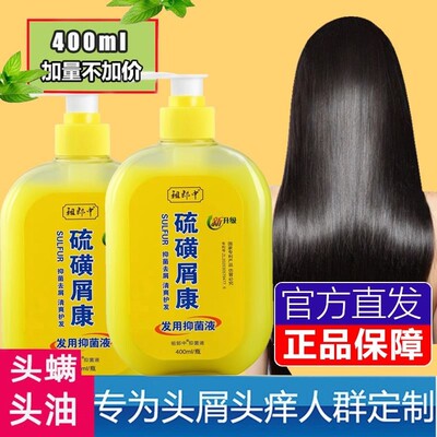硫磺皂上海洗头膏升级去头螨止痒