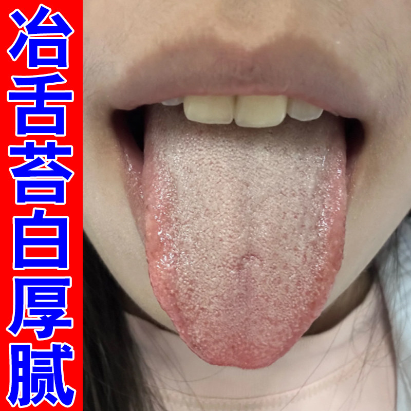 冶舌苔白厚腻口干口苦草本修护喷剂舌头有纹疼痛舌头发黄厚腻严重