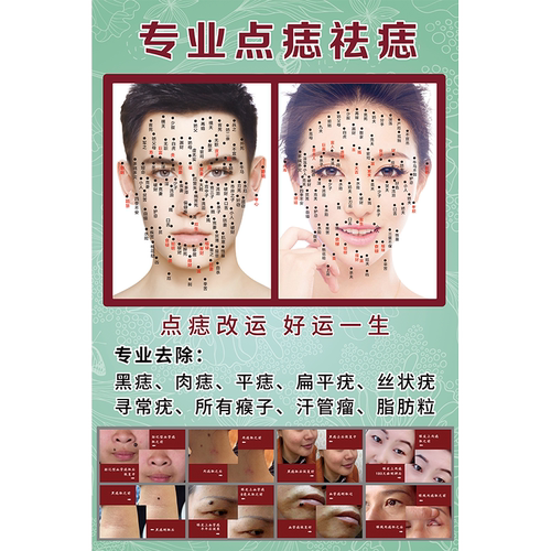 面部点痣宣传图痣相图祛斑祛痣男女面痣图取痣祛痣广告图片图解hb