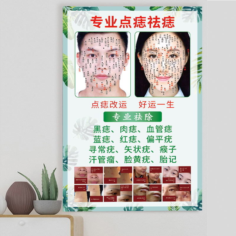 点痣图海报面部男女祛痣图片脸部取痣宣传画祛斑祛疣面相广告挂图