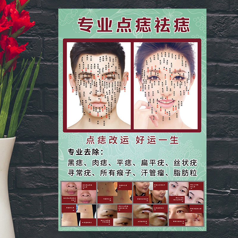 面部点痣宣传图痣相图祛斑祛痣男女面痣图取痣祛痣广告图片图解hb