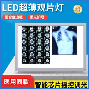 超薄医用X光观片灯led牙科阅片灯看片灯CT片单双三联骨科观片灯箱