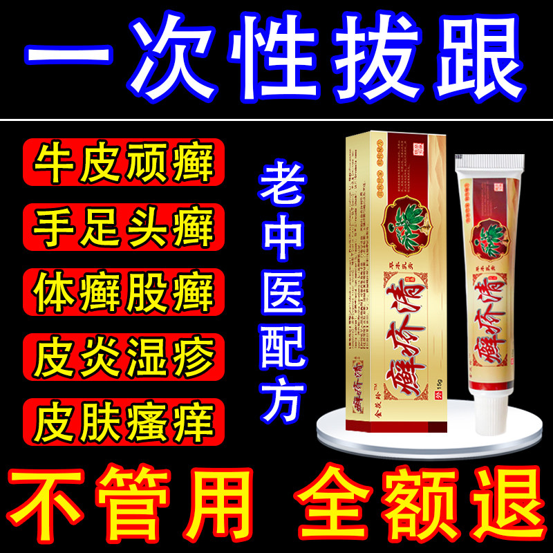 苗家牛皮藓银屑病股藓疹湿止痒根保健理疗