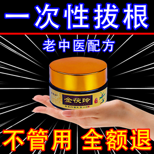 汗泡疱疹药膏手上起水小泡脱皮状汗疱疹痒汉状止真菌感染专用软膏