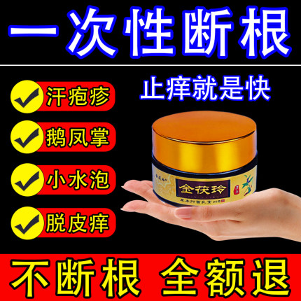汗泡疱疹药膏手上起小水泡脱皮汗状疱疹止痒汉状真菌感染专用软膏