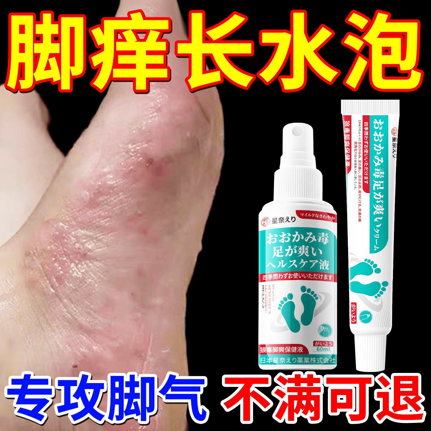 气脚痒脱皮真菌感染糜烂脚趾水泡型臭脚止汗止痒脱皮止痒膏旗舰店