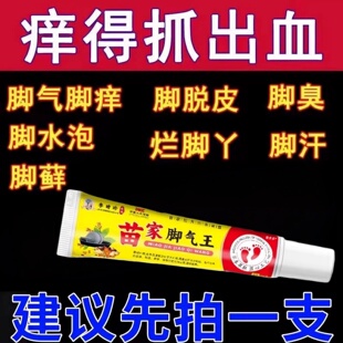 脚气根去专用止痒脱皮烂脚丫水泡杀菌脚痒真菌特效糜烂脚趾缝偏方