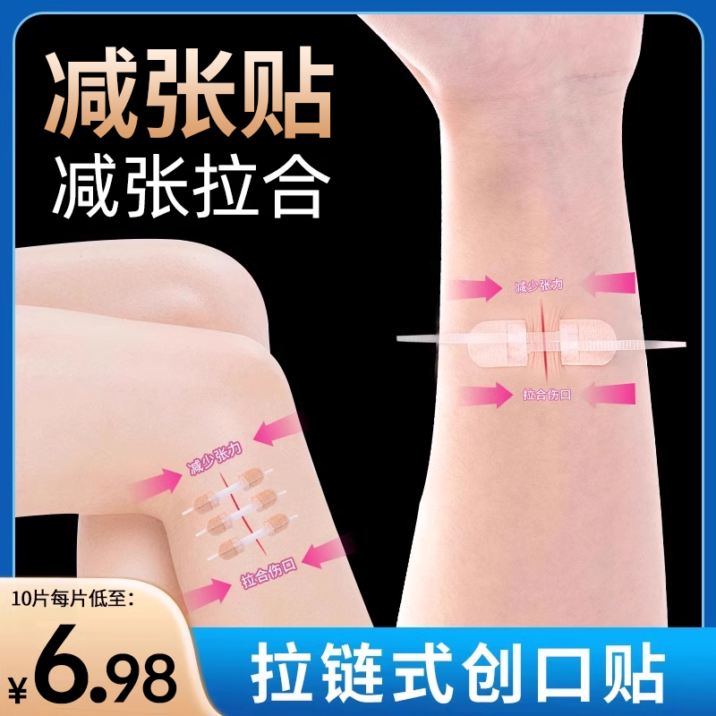 医用皮肤减张器拉链创口贴