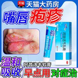 阿昔洛韦软膏带状疱疹唇炎水痘专用乳膏外用药膏正品官方旗舰店