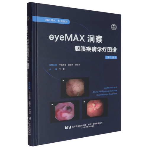 eyeMAX洞察胆胰疾病诊疗图谱