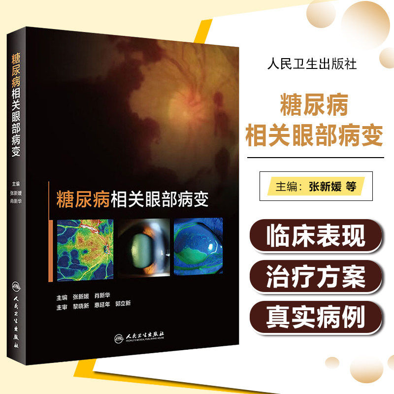 糖尿病相关眼部病变 眼毛细血管视网膜病变黄斑水肿眼表肌白内障眼底病视光视力恢复角膜青光眼人民卫生出版社实用手术眼科书籍