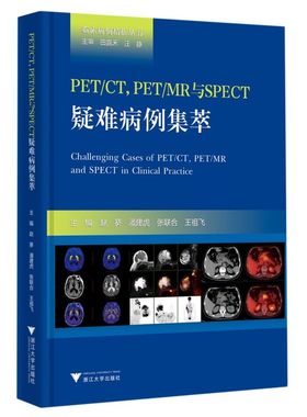 PET\CT PET\MR与SPECT疑难病例集萃(精)/