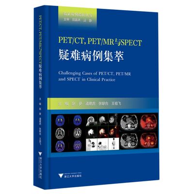 PET\CT PET\MR与SPECT疑难病例集萃(精)/