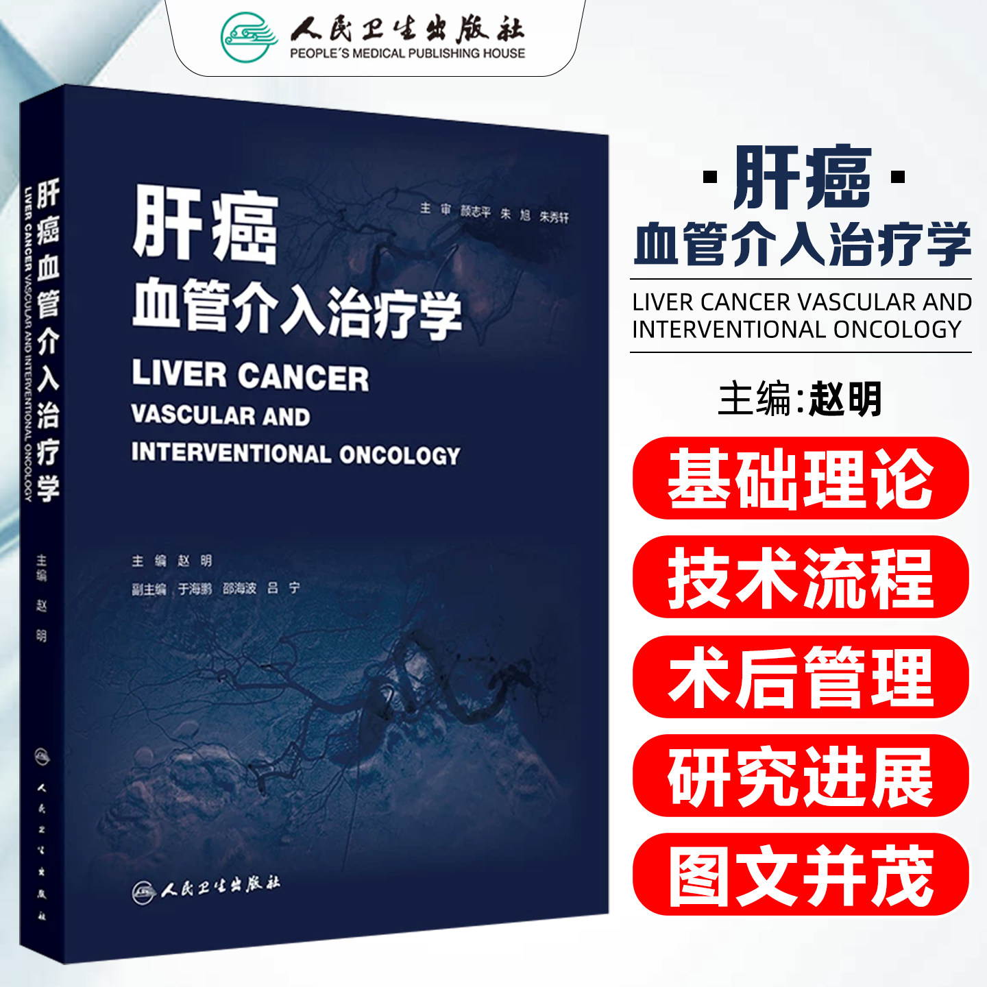 肝癌血管介入治疗学 赵明 主编 结合国内外肝癌诊疗指南专家共识及最新研究进展 紧贴临床实践需求 人民卫生出版社 9787117393676