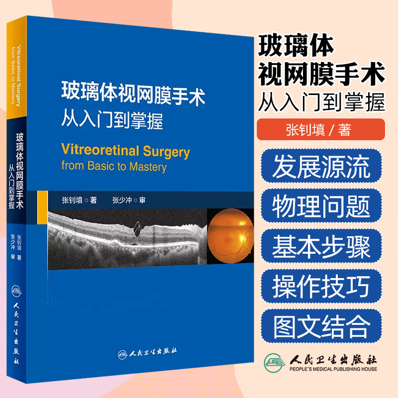 玻璃体视网膜手术从入门到掌握基本操作经验张钊填电子版孔源性视网膜脱离糖尿病病变儿童玻璃体黄斑眼底外科医师实用临床培训书