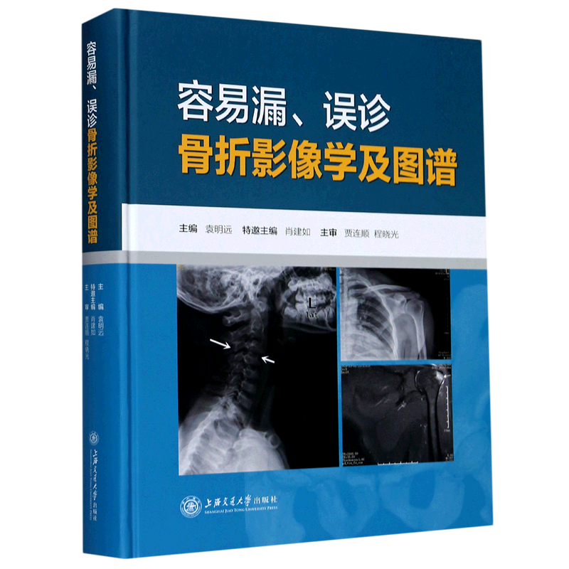 容易漏误诊骨折影像学及图谱(精)