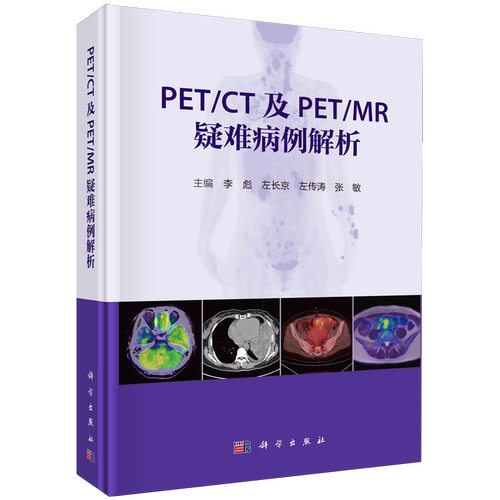 PET/CT及PET/MR疑难病例解析