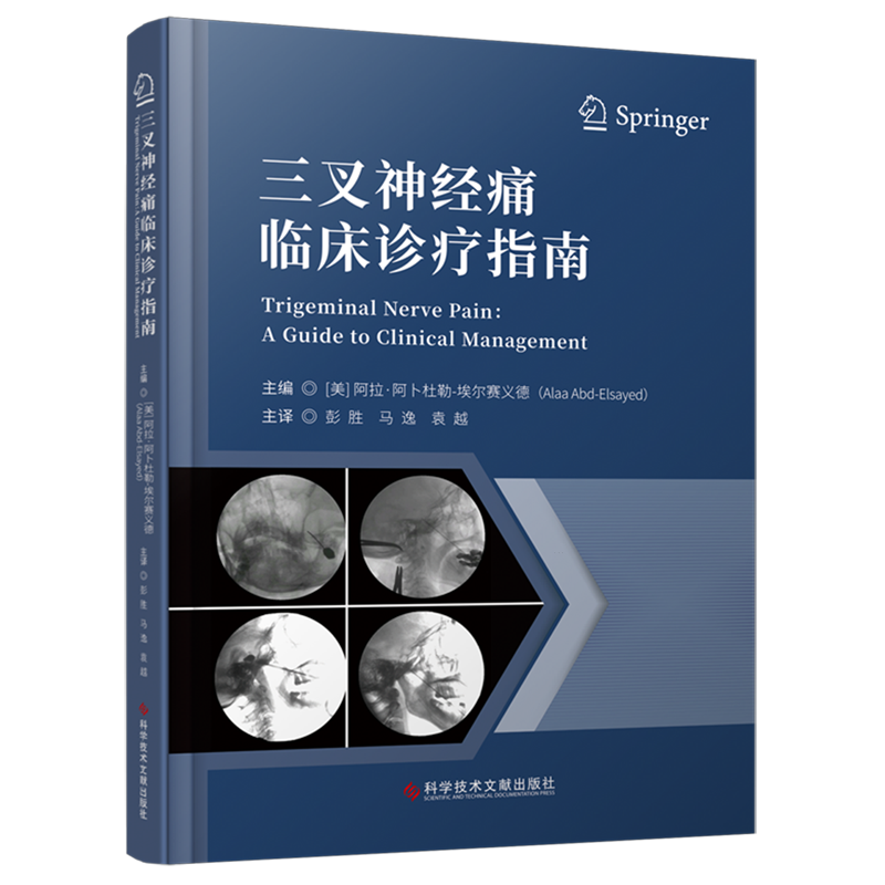 三叉神经痛临床诊疗指南